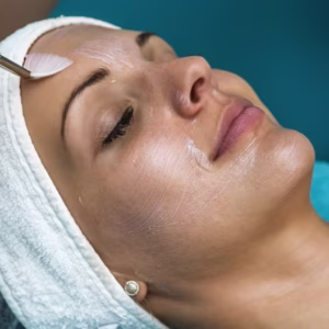 Chemical Peel